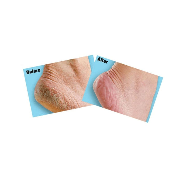O'Keeffes Healthy Feet Cream 91g
